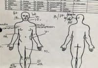 Grant’s medical exam revealed no injuries consistent with being dragged by his truck